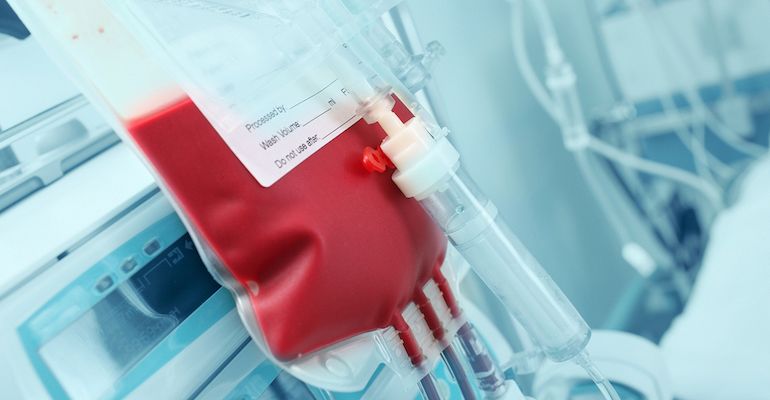 Echipament de plasmafereză pentru donatori.Foto:Ro Health Review